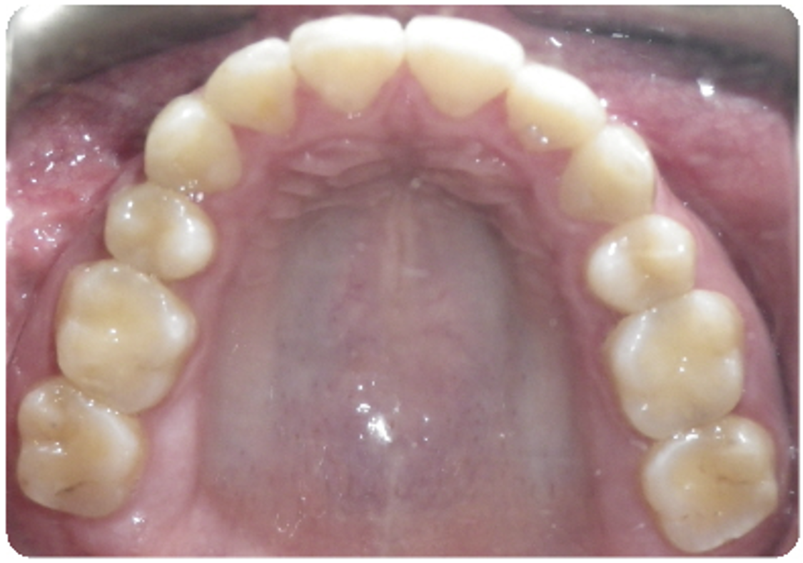 After treatment orthodontic case photo 1