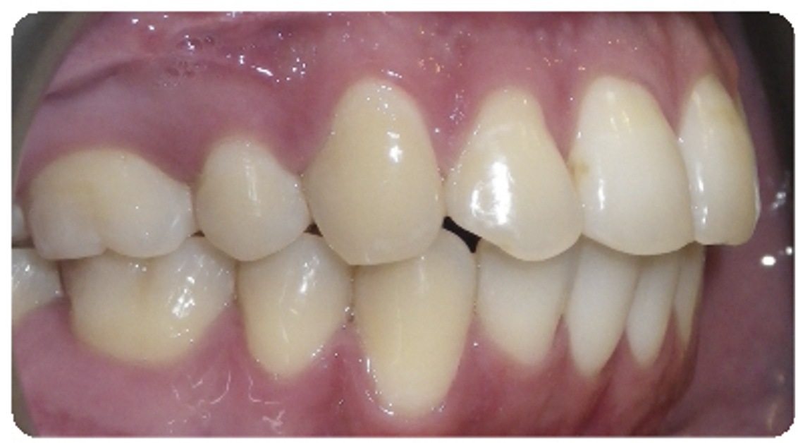 After treatment orthodontic case photo 3