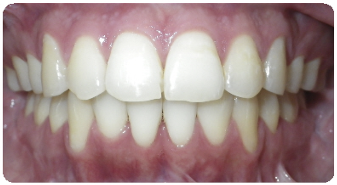 After treatment orthodontic case photo 4