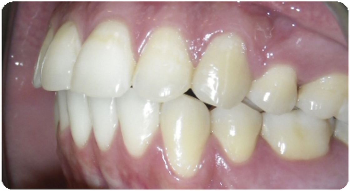 After treatment orthodontic case photo 5