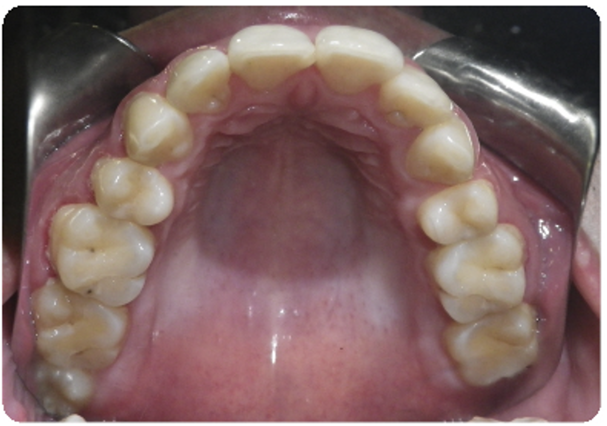 Before treatment orthodontic case photo 1
