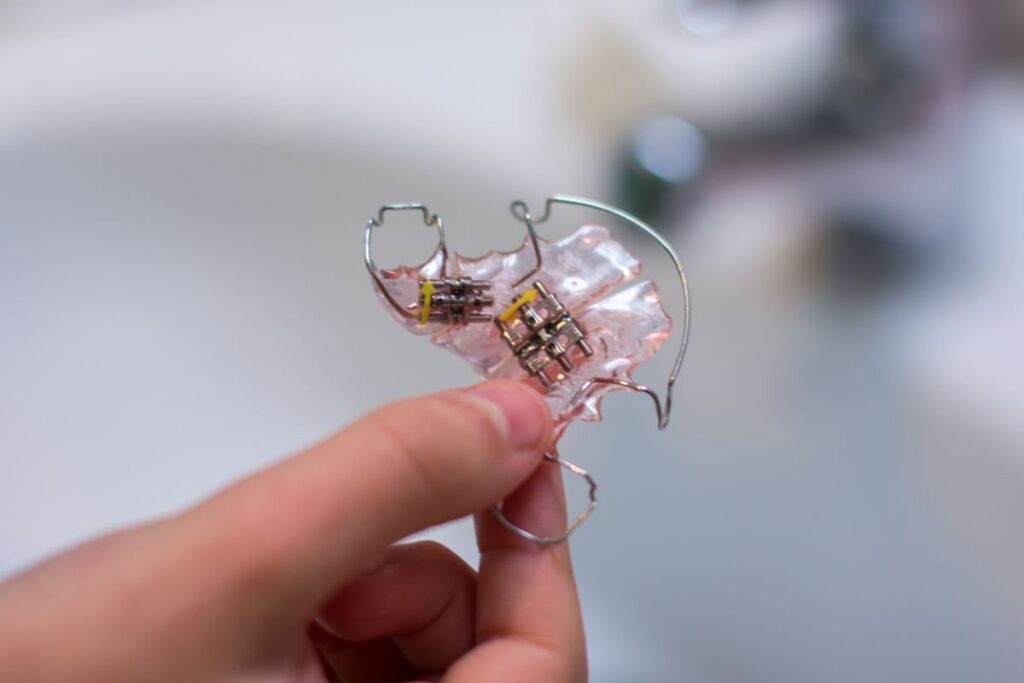 Close-up of a clear orthodontic appliance with metal brackets and wires held between fingers (dental braces component).